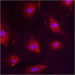 Anti-PMP70 antibody used in Immunocytochemistry/ Immunofluorescence (ICC/IF). GTX23421