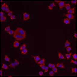 Anti-PMP70 antibody used in Immunocytochemistry/ Immunofluorescence (ICC/IF). GTX23421