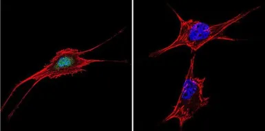 Anti-NFAT5 antibody used in Immunocytochemistry/ Immunofluorescence (ICC/IF). GTX23446
