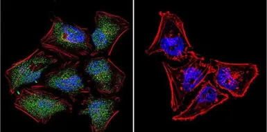 Anti-NFAT5 antibody used in Immunocytochemistry/ Immunofluorescence (ICC/IF). GTX23446