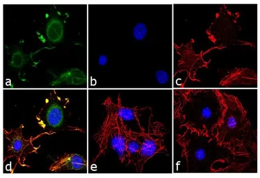 Anti-Adiponectin antibody used in Immunocytochemistry/ Immunofluorescence (ICC/IF). GTX23455