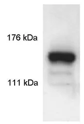 Anti-SIN3A antibody used in Western Blot (WB). GTX23479