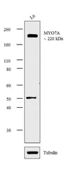 Anti-Myosin VIIa antibody used in Western Blot (WB). GTX23481