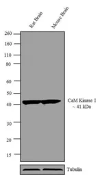 Anti-CaMK1 antibody used in Western Blot (WB). GTX23551