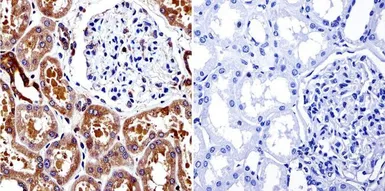 Anti-Calpain 1 antibody [9A4H8D3] used in IHC (Paraffin sections) (IHC-P). GTX23589
