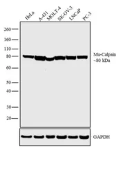 Anti-Calpain 1 antibody [9A4H8D3] used in Western Blot (WB). GTX23589