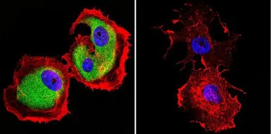 Anti-Calpain 1 antibody [9A4H8D3] used in Immunocytochemistry/ Immunofluorescence (ICC/IF). GTX23589