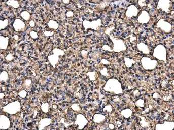 Anti-RAGE antibody used in IHC (Paraffin sections) (IHC-P). GTX23611
