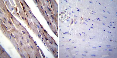 Anti-RAGE antibody used in IHC (Paraffin sections) (IHC-P). GTX23611
