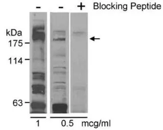 Anti-Claspin antibody used in Western Blot (WB). GTX23719