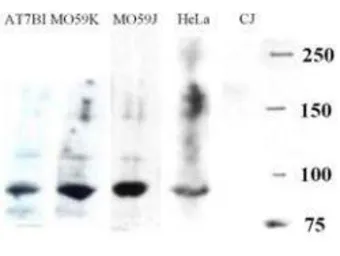 Anti-Artemis antibody used in Western Blot (WB). GTX23834