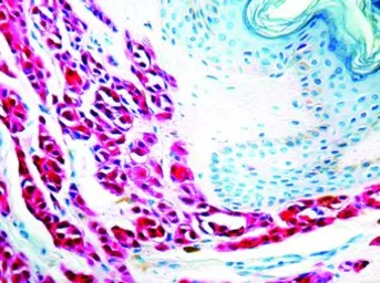 Anti-S100 antibody [4C4.9] used in IHC (Paraffin sections) (IHC-P). GTX24066