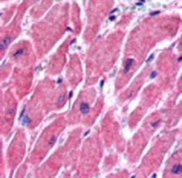 Anti-ALS2CR2 antibody used in IHC (Paraffin sections) (IHC-P). GTX24122