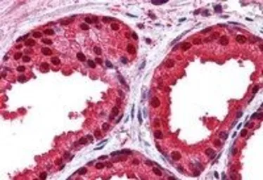 Anti-Park7 / DJ-1 antibody used in IHC (Paraffin sections) (IHC-P). GTX24150
