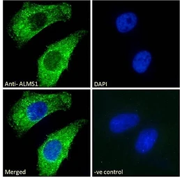 Anti-ALMS1 antibody used in Immunocytochemistry/ Immunofluorescence (ICC/IF). GTX24306