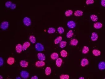 Anti-MCM2 antibody used in Proximity ligation assay (PLA). GTX24461
