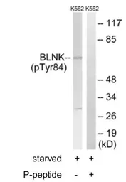 Anti-BLNK (phospho Tyr84) antibody used in Western Blot (WB). GTX24474