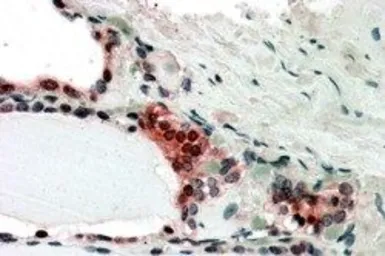 Anti-TRIP15 antibody, C-term used in IHC (Paraffin sections) (IHC-P). GTX24537