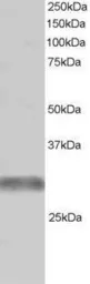 Anti-TRIM7 antibody, C-term used in Western Blot (WB). GTX24541