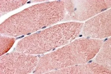 Anti-TRIM7 antibody, C-term used in IHC (Paraffin sections) (IHC-P). GTX24541