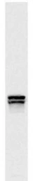 Anti-Lys 20p + 21p antibody [31F5] used in Western Blot (WB). GTX24574