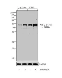 Anti-ATF2 (phospho Thr71) antibody used in Western Blot (WB). GTX24736