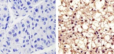 Anti-PYK2 (phospho Tyr402) antibody used in IHC (Paraffin sections) (IHC-P). GTX24800