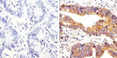 Anti-Src (phospho Tyr416) antibody used in IHC (Paraffin sections) (IHC-P). GTX24816
