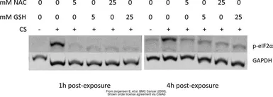 Anti-eIF2 alpha (phospho Ser51) antibody used in Western Blot (WB). GTX24837
