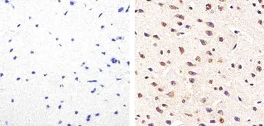 Anti-Tau (phospho Ser214) antibody used in IHC (Paraffin sections) (IHC-P). GTX24846