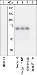 Anti-Tau (phospho Ser214) antibody used in Western Blot (WB). GTX24846