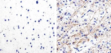 Anti-Tau (phospho Ser262) antibody used in IHC (Paraffin sections) (IHC-P). GTX24856