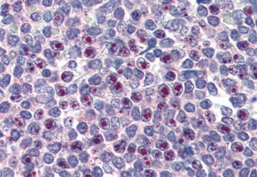 Anti-FOXC1 antibody, C-term used in IHC (Paraffin sections) (IHC-P). GTX25079