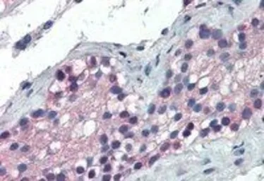 Anti-FOXE1 antibody, C-term used in IHC (Paraffin sections) (IHC-P). GTX25080