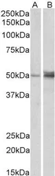Anti-FOXL2 antibody, C-term used in Western Blot (WB). GTX25096