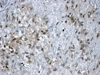 Anti-FOXL2 antibody, C-term used in IHC (Paraffin sections) (IHC-P). GTX25096