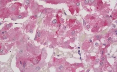 Anti-FOXL2 antibody, C-term used in IHC (Paraffin sections) (IHC-P). GTX25096