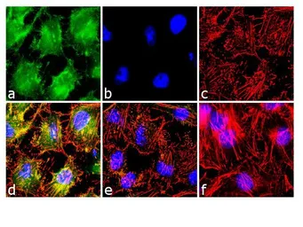 Anti-NFAT1 (phospho Ser54) antibody used in Immunocytochemistry/ Immunofluorescence (ICC/IF). GTX25246