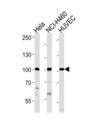Anti-EphA4 antibody used in Western Blot (WB). GTX25396