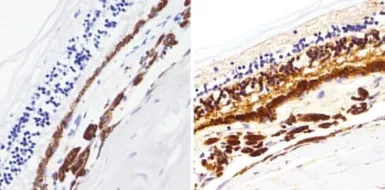 Anti-Rhodopsin antibody [1D4] used in IHC (Paraffin sections) (IHC-P). GTX25417