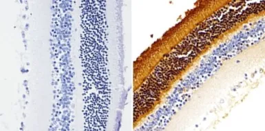 Anti-Rhodopsin antibody [1D4] used in IHC (Paraffin sections) (IHC-P). GTX25417