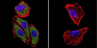 Anti-Calpain 1 antibody [2H2A7C2] used in Immunocytochemistry/ Immunofluorescence (ICC/IF). GTX25441