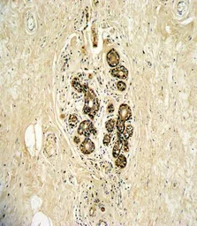 Anti-Her3 / ErbB3 antibody used in IHC (Paraffin sections) (IHC-P). GTX25470