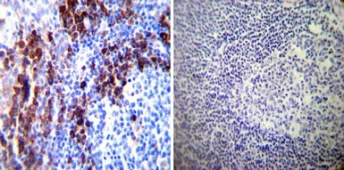 Anti-PDI antibody [RL77] used in IHC (Paraffin sections) (IHC-P). GTX25484