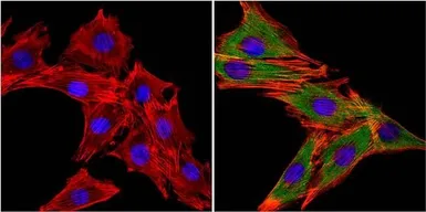 Anti-MUSK antibody used in Immunocytochemistry/ Immunofluorescence (ICC/IF). GTX25619