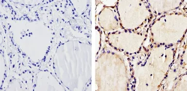 Anti-Thyroid Hormone Receptor alpha antibody used in IHC (Paraffin sections) (IHC-P). GTX25621