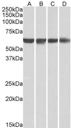 Anti-PTBP1 antibody, N-term used in Western Blot (WB). GTX25642