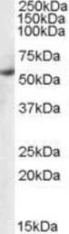 Anti-PTBP1 antibody, N-term used in Western Blot (WB). GTX25642