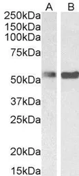 Anti-PTBP1 antibody, N-term used in Western Blot (WB). GTX25642