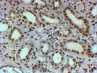 Anti-PTBP1 antibody, N-term used in IHC (Paraffin sections) (IHC-P). GTX25642